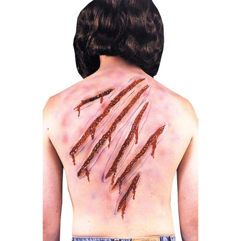 Nail Scars