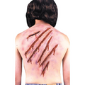 Nail Scars