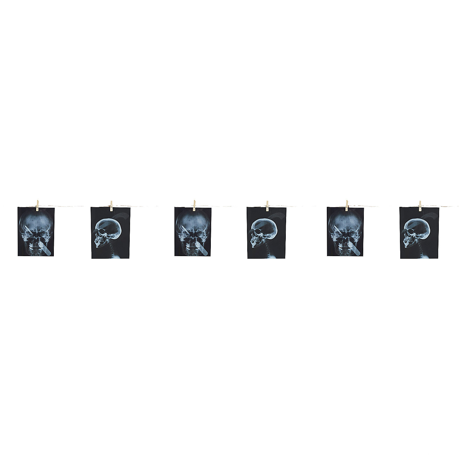 GARLAND-TORTURE X-RAY 63 IN.