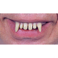 Ghoul Teeth
