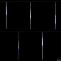 Northlight Set of 10 White LED Dripping Snowfall Icicle Christmas Lights - 20.5 ft Clear Wire